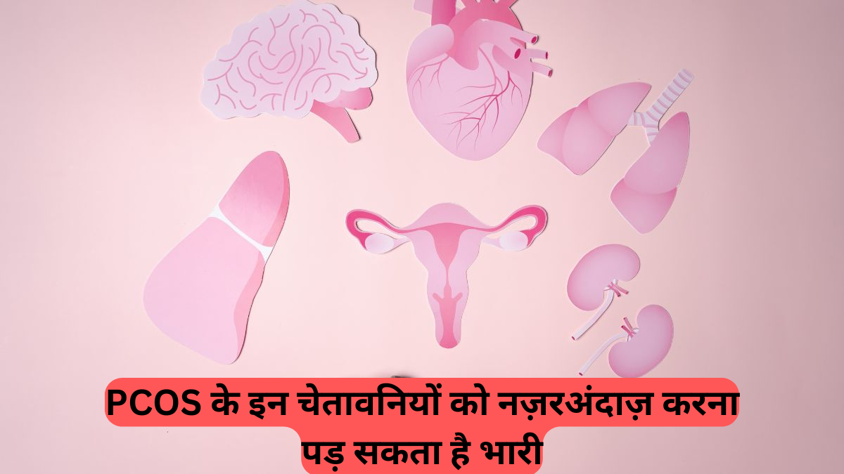PCOS: ये 5 शुरुआती लक्षण अनदेखा न करें, स्त्री रोग विशेषज्ञ की सलाह