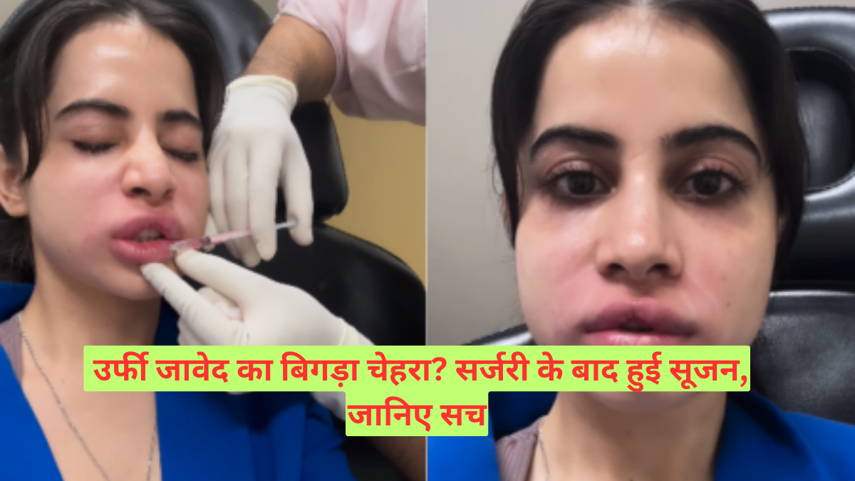 उर्फी जावेद का बिगड़ा चेहरा? सर्जरी के बाद हुई सूजन, जानिए सच