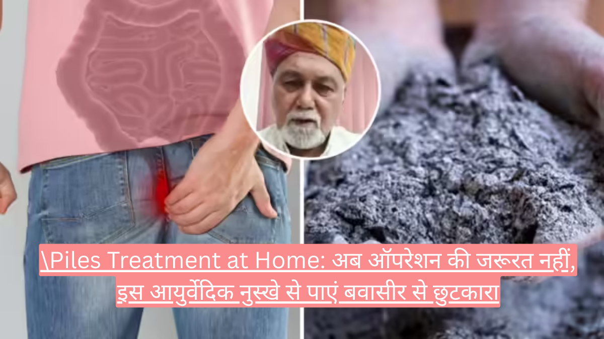 Piles Treatment at Home: अब ऑपरेशन की जरूरत नहीं, इस आयुर्वेदिक नुस्खे से पाएं बवासीर से छुटकारा
