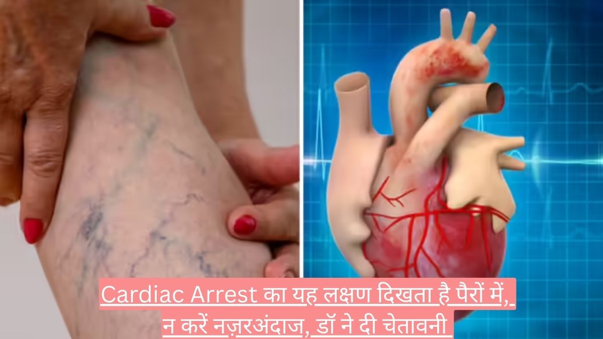 Cardiac Arrest का यह लक्षण दिखता है पैरों में, न करें नज़रअंदाज, डॉ ने दी चेतावनी