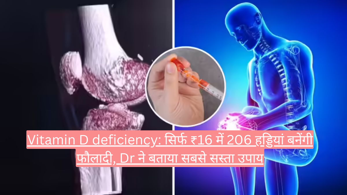 Vitamin D deficiency: सिर्फ ₹16 में 206 हड्डियां बनेंगी फौलादी, Dr ने बताया सबसे सस्ता उपाय