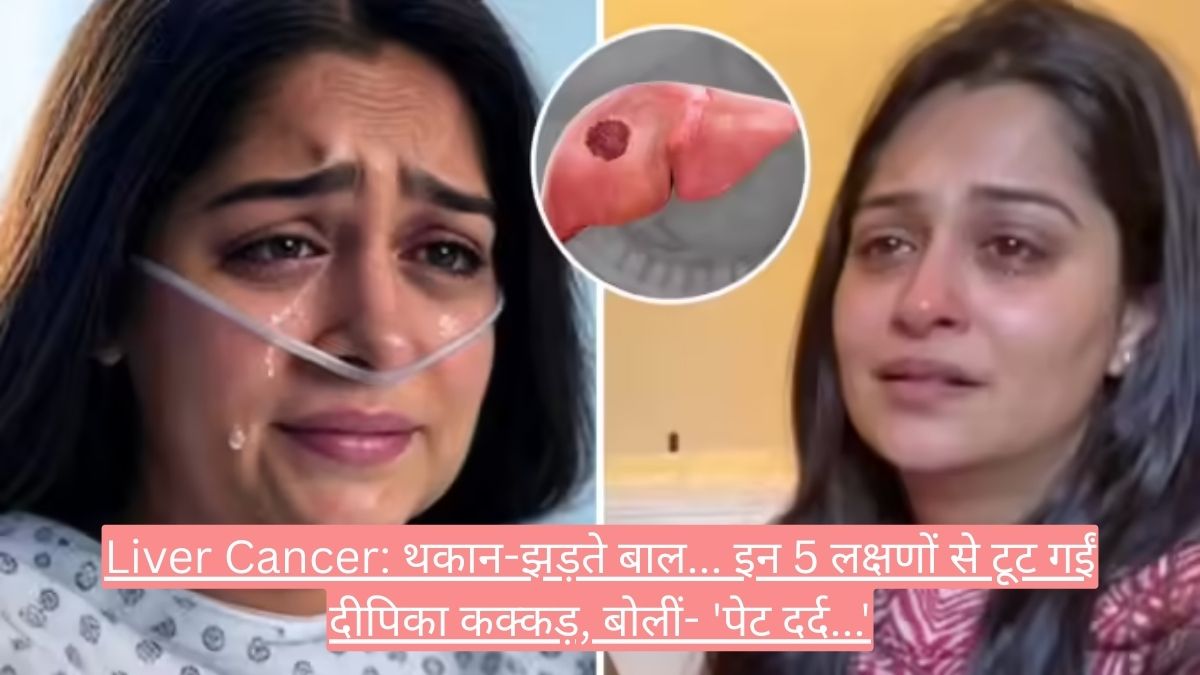 Liver Cancer: थकान-झड़ते बाल... इन 5 लक्षणों से टूट गईं दीपिका कक्कड़, बोलीं- 'पेट दर्द...'